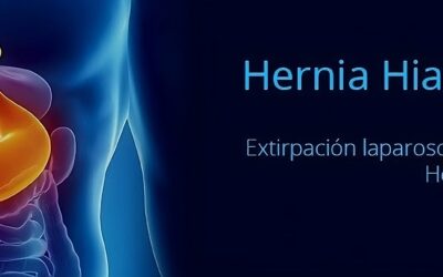 Cirugía de hernia hiatal por laparoscopia